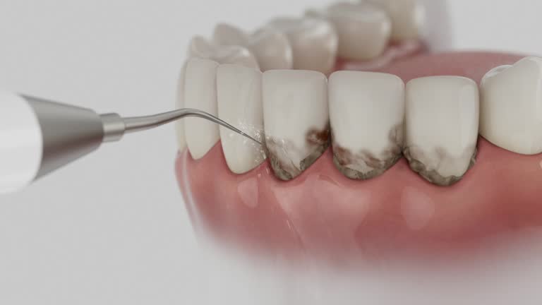 Reliable Root Canal Treatment contractor in Allamakee County County, IA by Dentist Open Now